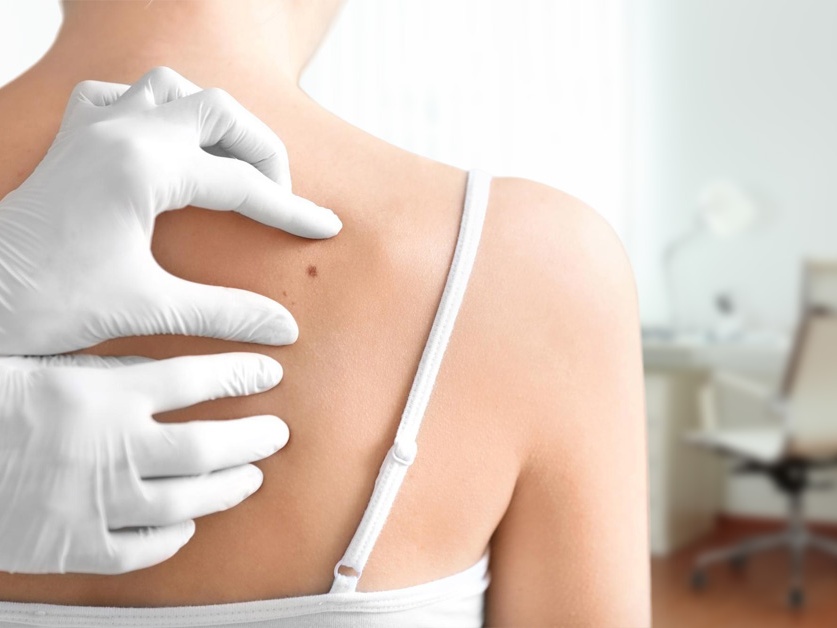 Kožní ambulance - MUDr. Vladimíra Pasovská