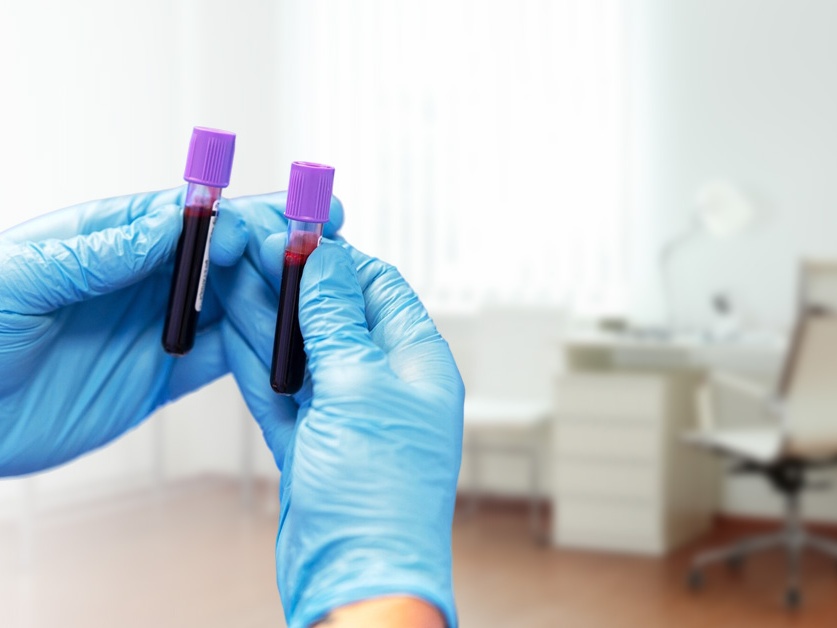 SYNLAB - odběrové pracoviště Kralupy nad Vltavou (ul. Mostní)